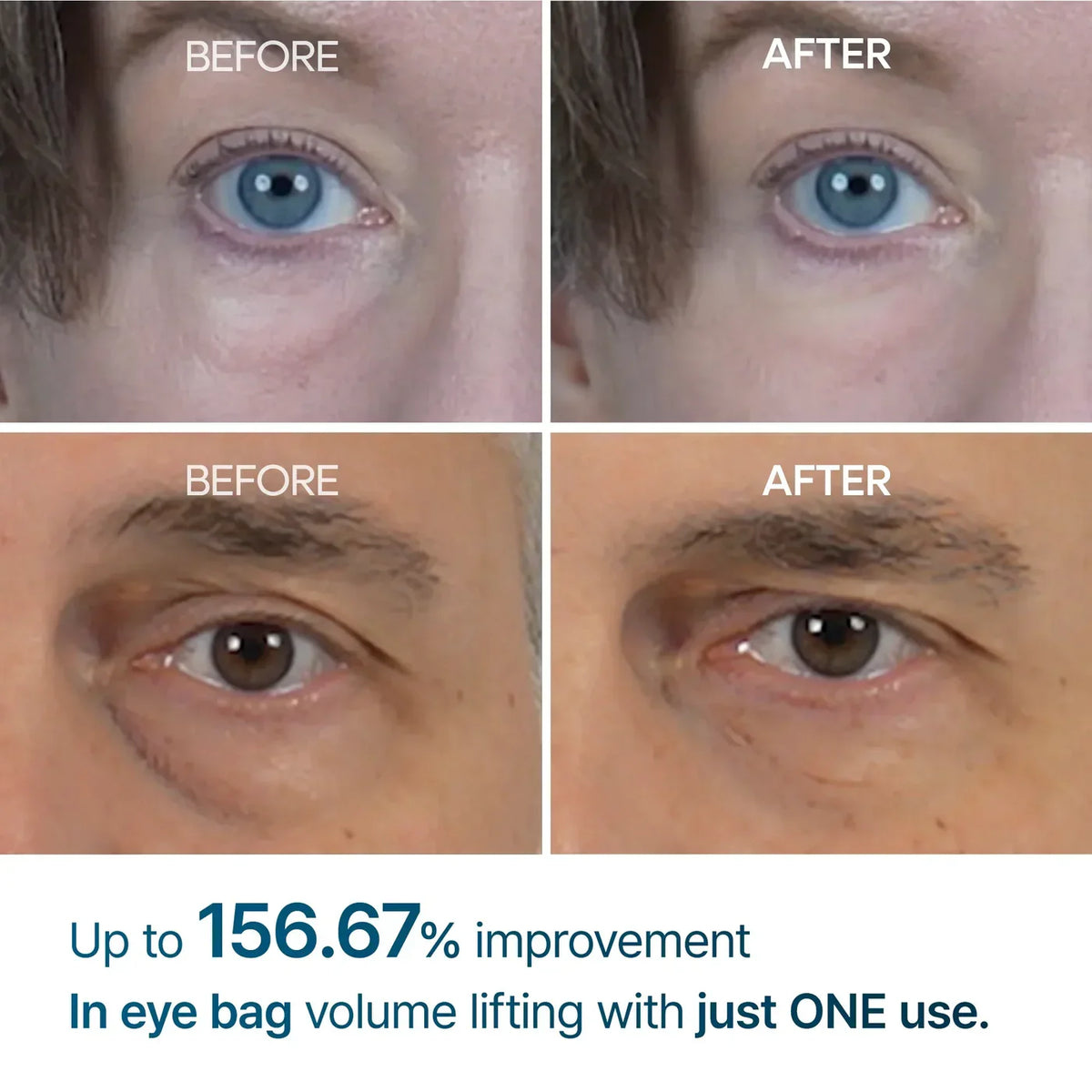 Alavora® Eyebag Cream
