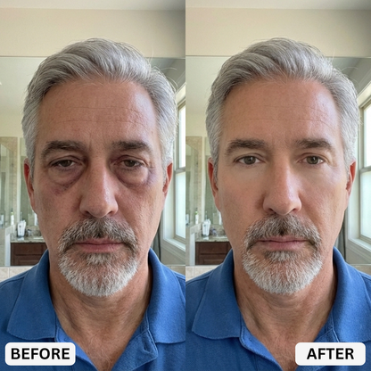Alavora® Eyebag Cream