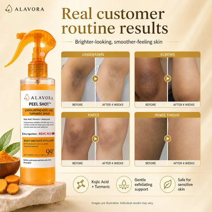 Alavora Spray Peeling Corporal con Ácido Kójico + Cúrcuma