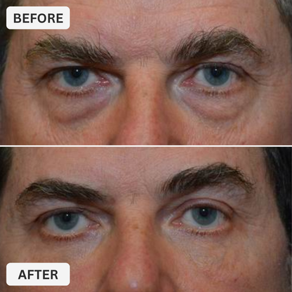 Alavora® Eyebag Cream
