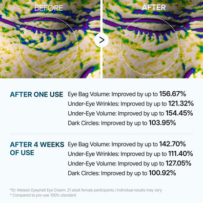 Alavora® Eyebag Cream