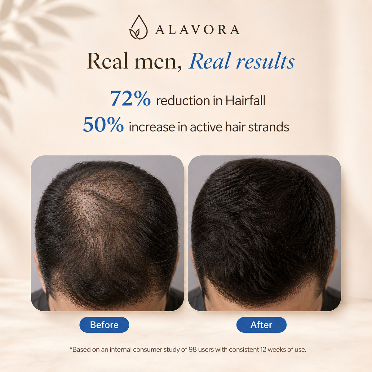 Alavora® Sérum Capilar