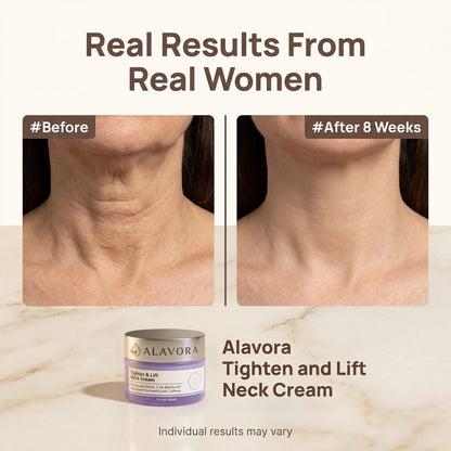 Alavora® Tighten & Lift Neck Cream