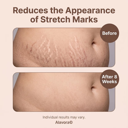 Alavora® Tighten & Smooth Belly Cream