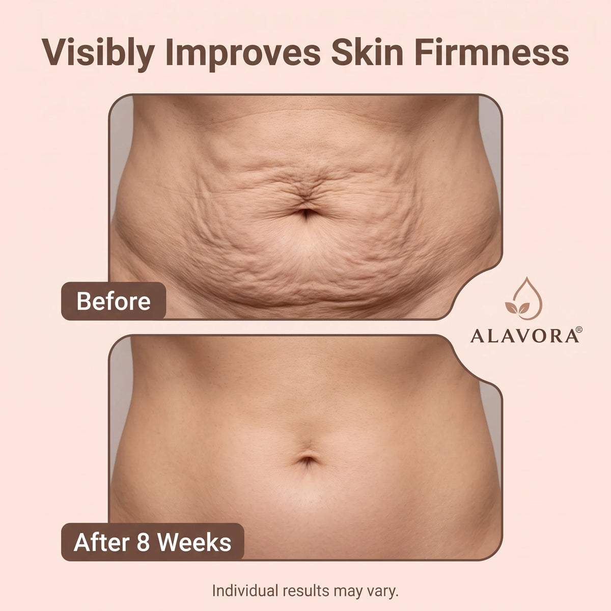 Alavora® Tighten & Smooth Belly Cream