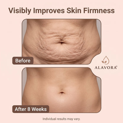 Alavora® Tighten & Smooth Belly Cream